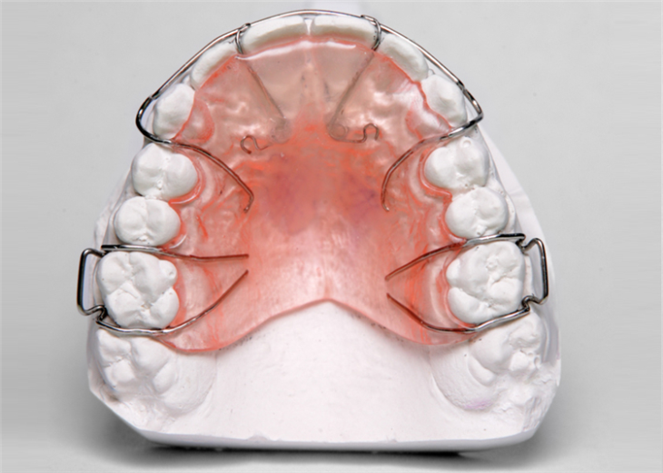 Wis Essix Retainer